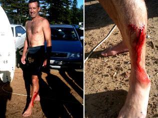 078929-sydney-shark-attack.jpg