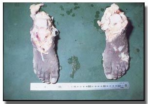 feet.jpg