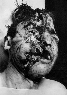 suicidephotograph017.jpg