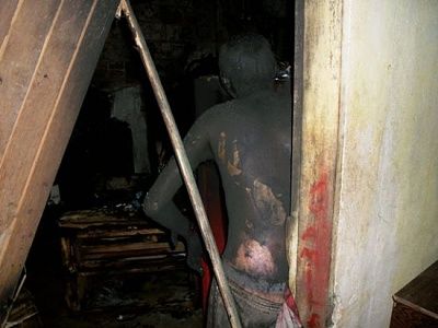 man_electrocuted_burned_3.jpg