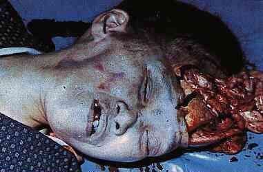 random_collection_of_gore_004.jpg