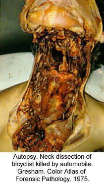 random_collection_of_gore_002.jpg