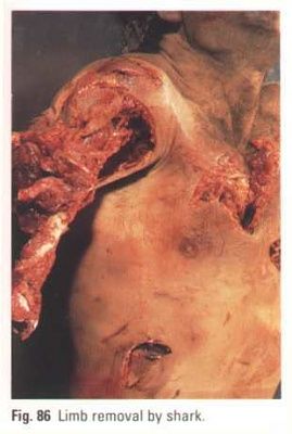 random_collection_of_gore_014.jpg