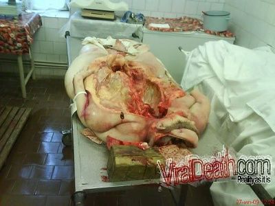 pictures_from_morgue_2.jpg