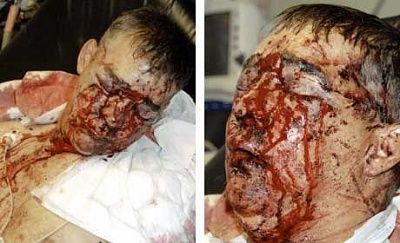 must-use-advisory-images-injuries-suffered-pc-david-rathband-who-allegedly-shot-.jpg