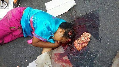 dead-20biker-20brain-20ejection-20-281-29.jpg