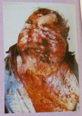 eugene-terre-blanche-murder-scene-bed-face-close-up-3.jpg