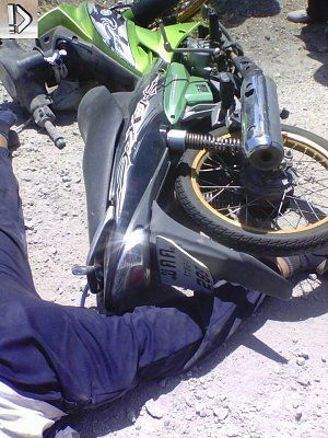faceplant-20scooter-20-283-29.jpg