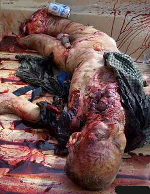 my_random_gore_pics_001.jpg
