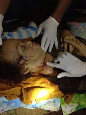 woman-20head-20and-20neck-20trauma-20-281-29.jpg