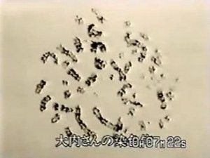 Hisashi%20Ouchi%20DNA%20after%20exposure.jpg