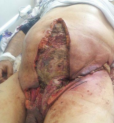 gutsopenforbusinessmedicalimagesfromapatientwhoreallyhasafuckedupgutproblem-1.jpg