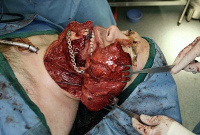 ilikemedicalpicturesbutthisonetakesthecake-1.jpg
