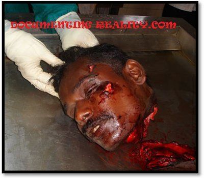 railway-accident-complete-decapitation-rail-decapitation-02.jpg
