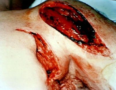 stab1_450x350.jpg