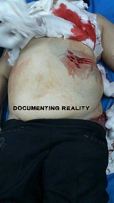 woman-shot-during-robbery-02.jpg