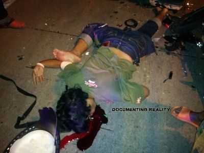 motorcycle-death-bad-leg-01.jpg