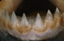teeth.PNG