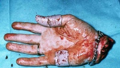 accident-prone.jpg