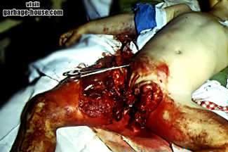 car_crash_victim_l.jpg
