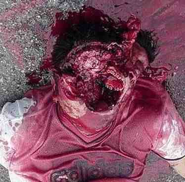 shotgun-wound-face-gruesome-victim-pic.jpg