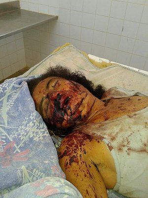 33-20yo-20woman-20stabbed-20in-20the-20neck-2001.jpg