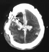 247017-247664-945tn.jpg