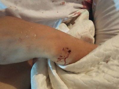 36-20yo-20woman-20shot-20by-20boyfriend-2015.jpg