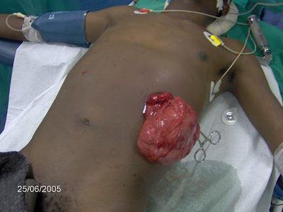 Name:  17gunshotabdomen.JPG
Views: 5035
Size:  19.9 KB