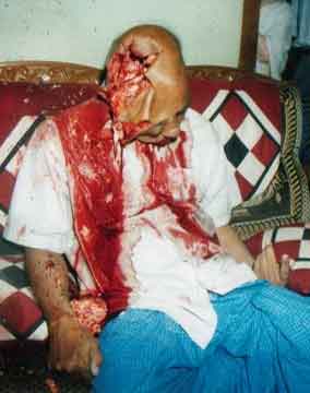 shotgun blast.jpg