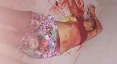 Name:  stabbed24yo2.jpg
Views: 939
Size:  17.7 KB