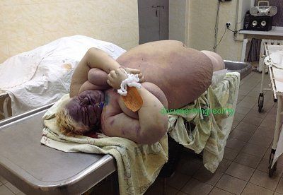 obese1.jpg