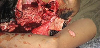 head-wound2.jpg