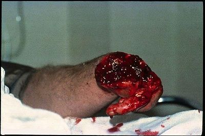 hand-1.jpg