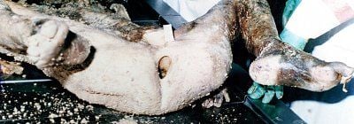 29dfe-cadaver2b01.jpg