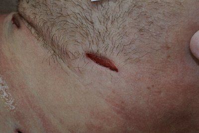 homocide-20victim-20martin-20h-c3-a5kansson-2011.jpg