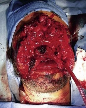 Harley%20Biker%20Hits%20Guardrail.jpg