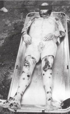 robert-20curley-20corpse-20exhumed-201994-20poisoned-20by-20wife-20in-20sept-201991.jpg