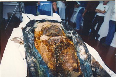 reed-20autopsy6.jpg