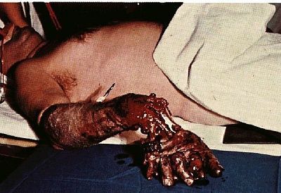 arm-2.jpg