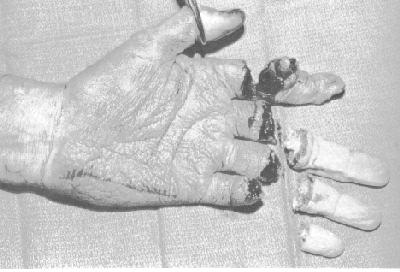 arm 5.jpg