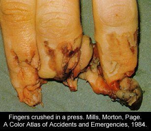 fingers1.jpg