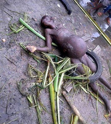 emaciate-person-bloat-belly-beat-death-africa-01.jpg