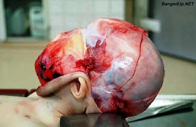 heyskinhead1.jpg