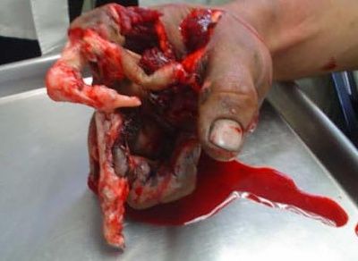 lolhand.jpg