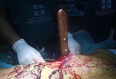 stabbed_by_wife1-1-.jpg