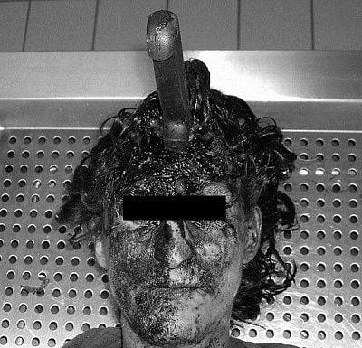 charonboat_dot_com_schizophrenia_suicide1.jpg