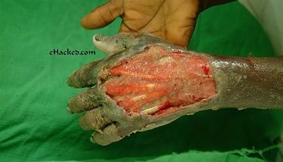 boiledhand.jpg