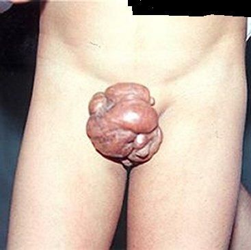 snuffx-dot-com-mutated-dick.jpg