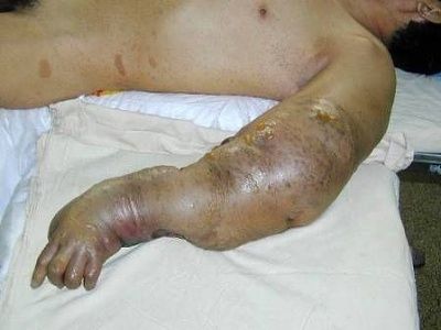 arm2.jpg